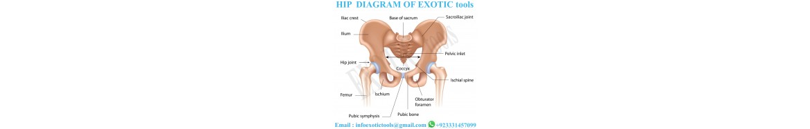 Hip Surgery